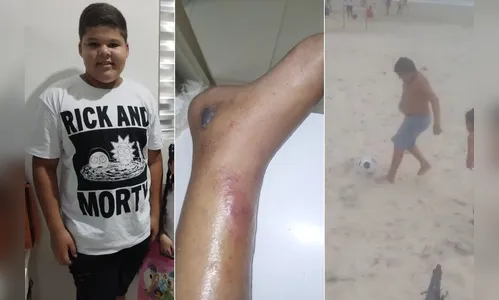 Menino de 12 anos morre em decorrência de fratura causada em futebol