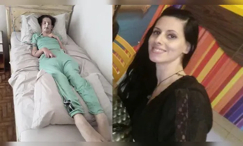 Família pede ajuda para tratamento de mulher com lúpus em Arapongas