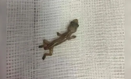 Criança contrai infecção após madrasta obrigá-la a comer lagartixa