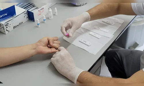 Dia mundial contra Aids: casos positivos de HIV caem 25% em Apucarana