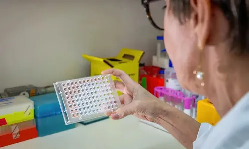 Teste feito pelo Butantan detecta leptospirose em estágio inicial