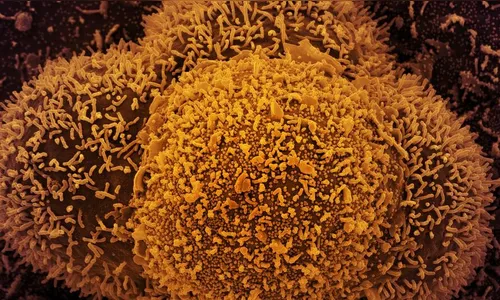 Nova subvariante da covid-19 é identificada em Mato Grosso