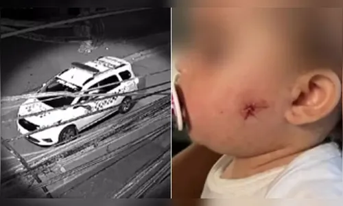 Policial é investigado por atirar no rosto de bebê com arma de airsoft