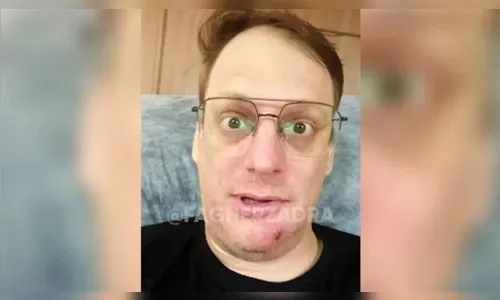 Humorista do PR tem paralisia facial após espremer espinha; veja vídeo