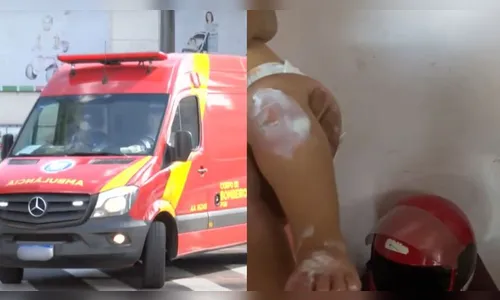 Bebê de 1 ano sofre queimadura de sol em espaço recreativo de Londrina