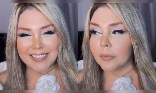 Simony revelou que devido ao tratamento seu rosto está inchando