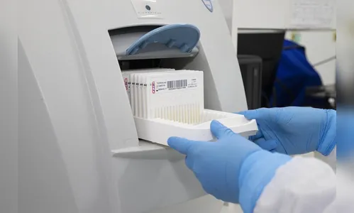 Tecpar implanta ensaios que reduzem tempo de análise laboratorial