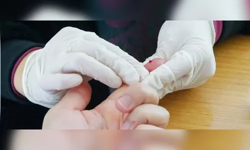 Teste gratuito para Aids será oferecido na UEM nesta sexta-feira (23)