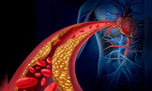 Quais os fatores que levam uma pessoa a ter colesterol alto?