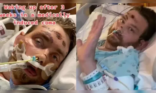 Homem fica em coma após tentar remover pelo encravado da virilha