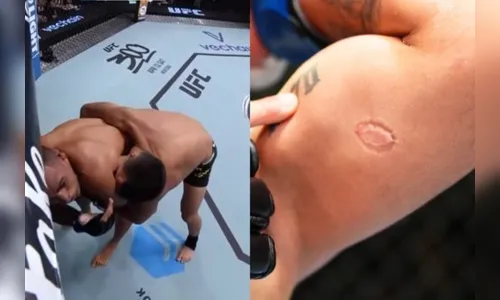 Brasileiro é demitido após morder rival ao estrear no UFC; veja vídeo
