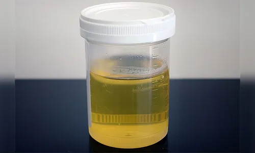 Ladrão assalta pedestre e leva sacola com amostras de urina