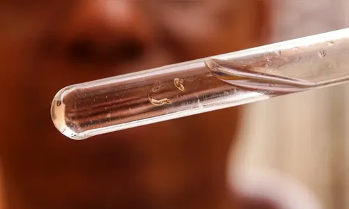 Brasil registra mais de um milhão de casos de dengue em 2024