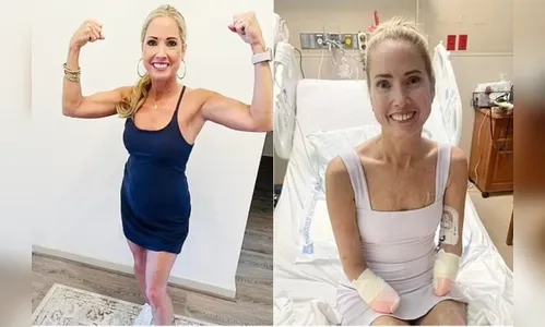 Mulher perde mãos e pés após infecção que começou com dor de garganta