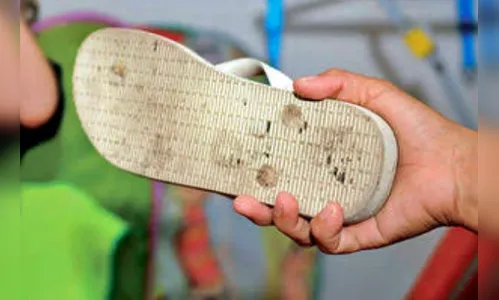 Mulher é agredida com chineladas no rosto pelo companheiro