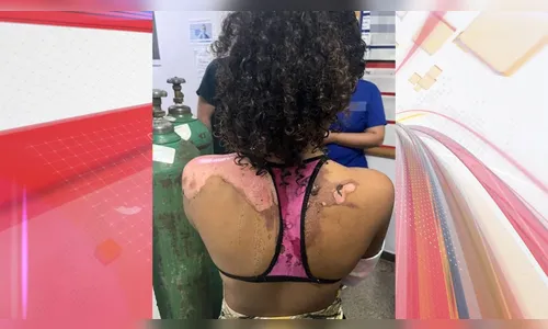 Mulher que jogou água quente na sobrinha por ciúme do marido é presa