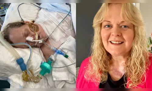 Infecção por bactéria 'comedora de carne' quase leva mulher à morte