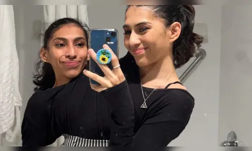 Gêmeas siamesas, unidas pelo tórax, falam sobre namoro e rotina