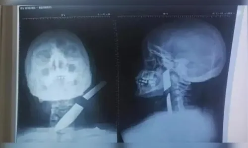 Homem é preso ao enfiar faca no pescoço de ex-mulher