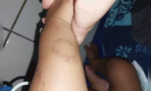 Mãe e padrasto são detidos por tortura contra bebê; vítima está na UTI