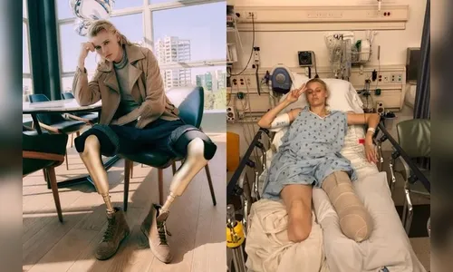 Modelo perde as duas pernas devido a uso de absorvente interno