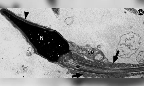 Vírus covid-19 pode permanecer no sêmen até 110 dias após infecção