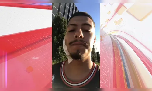 Baleado por submetralhadora deixa hospital com bala alojada na nuca