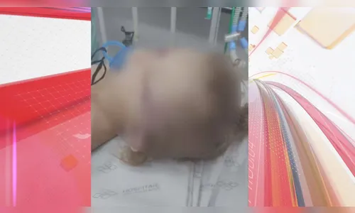 Criança de 4 anos é agredida e torturada; mãe e padrasto estão presos
