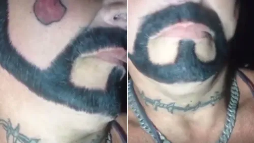 Homem decidiu refazer a tatuagem de barba no rosto