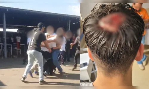 Aluno leva 9 pontos na cabeça após briga em escola estadual; veja