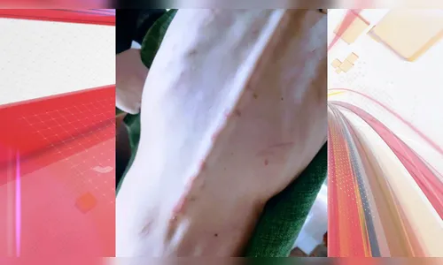 Mãe é presa por agredir filha com esquizofrenia e deixá-la desnutrida