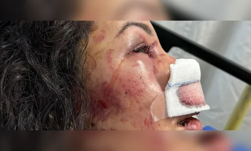 Moradora do Paraná é espancada durante assalto no Chile