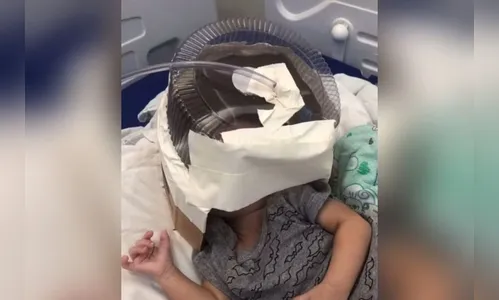 Bebê que usou embalagem de bolo como máscara de oxigênio deixa UTI