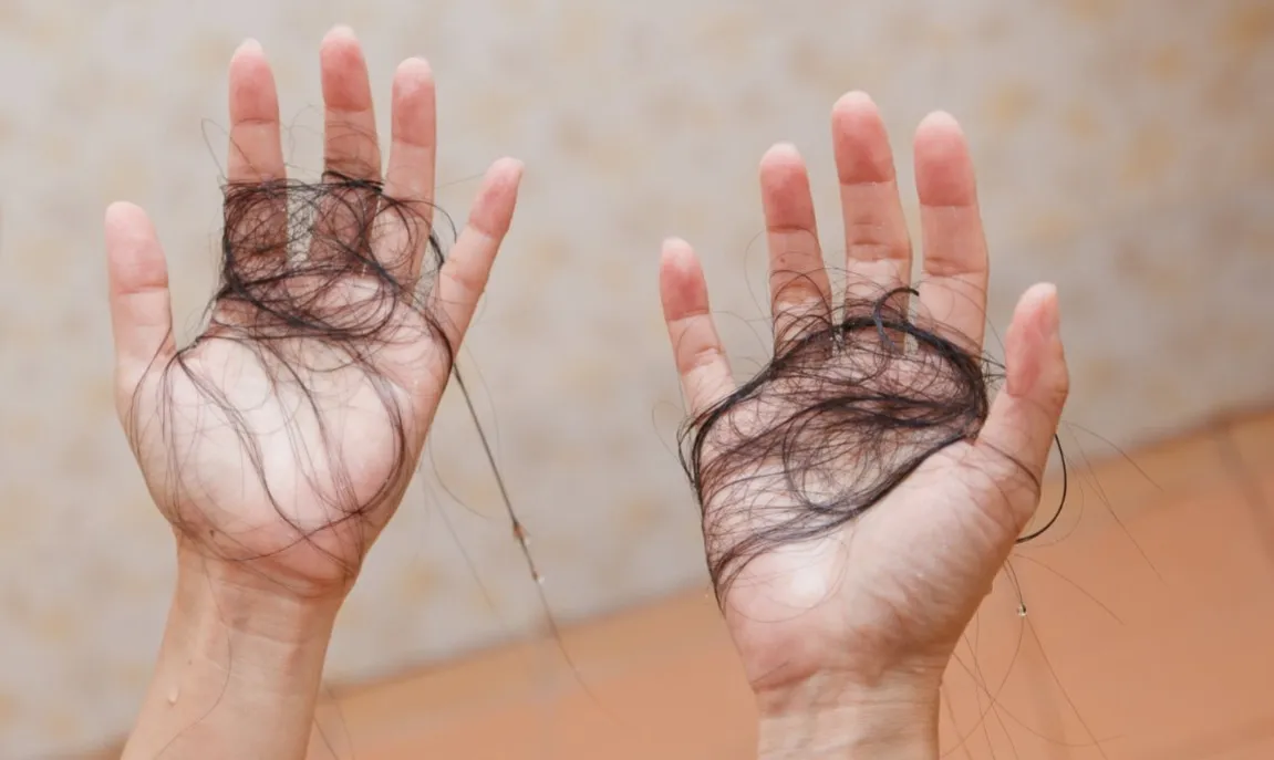 Mulher tem cabelo arrancado ao apanhar por ciúmes de rede social