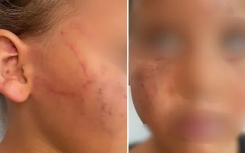 A criança foi encontrada com várias marcas de agressão