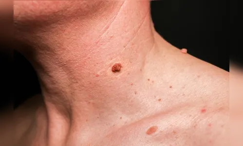 Homem é preso após tentar estrangular esposa em Apucarana