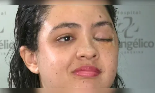 Titânio em cirurgias: saiba como o metal ajuda na reconstrução de face