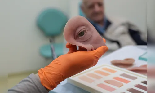 Próteses faciais recuperam autoestima de pacientes no PR