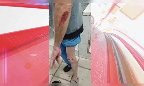 Motociclista sofre acidente após ataque de cão na região de Apucarana