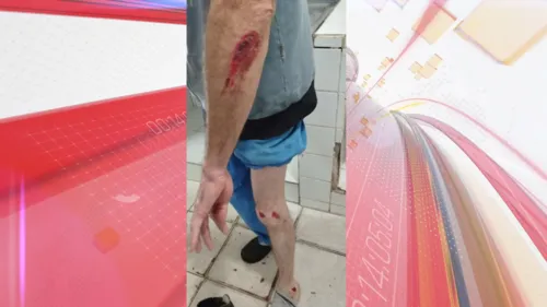 Averaldo caiu de moto após ser atacado por um cachorro