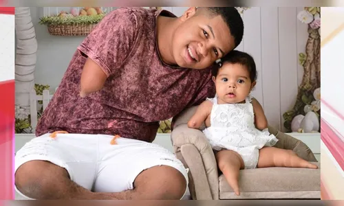 Irmãos que nasceram sem as mãos e pés conquistam internet