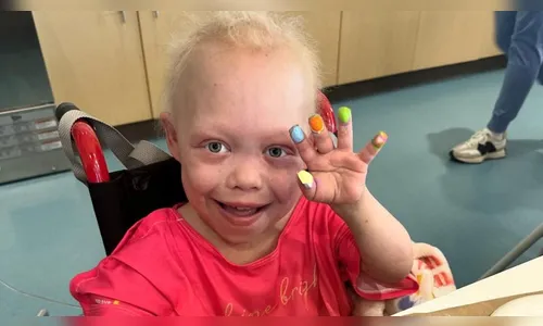 Tiktoker com doença rara, Bella Brave, morre aos 10 anos