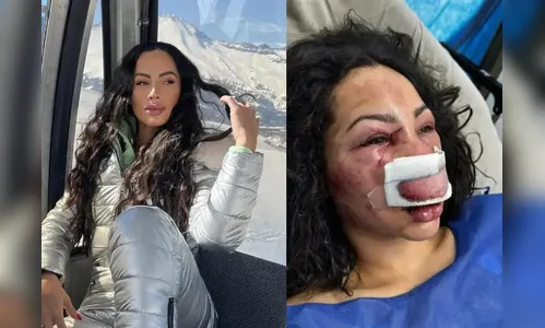 Veja o que se sabe sobre o ataque sofrido por paranaense no Chile