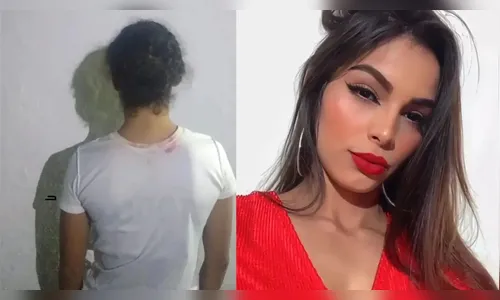 Ex-namorado foi mandante de ataque com soda cáustica em jovem, diz MP