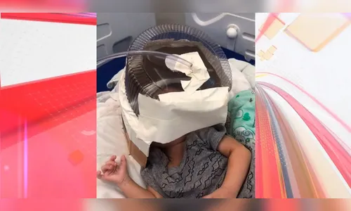 Morre bebê que usou respirador feito com embalagem de bolo