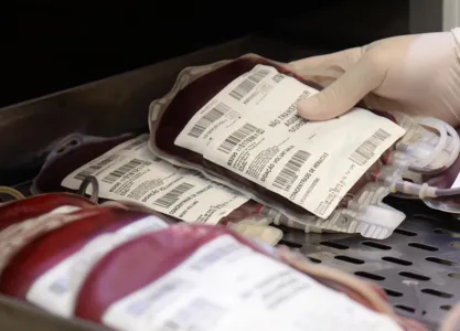 (Sesa) reforçou nesta quarta-feira (24) pedido de urgência de doações de sangue