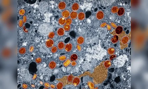 Quem pode tomar a vacina contra Monkeypox? Tire suas dúvidas