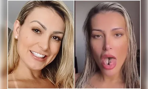 Andressa contou quanto investiu para realizar o procedimento. "R$1.350. Achei barato."
