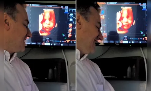 Bebê reage ao pai e o surpreende em ultrassom: 