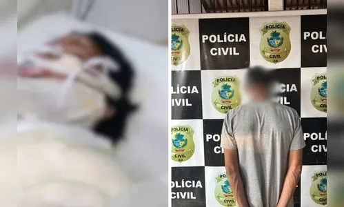 Morre mulher que foi queimada ao descobrir que filhas eram abusadas